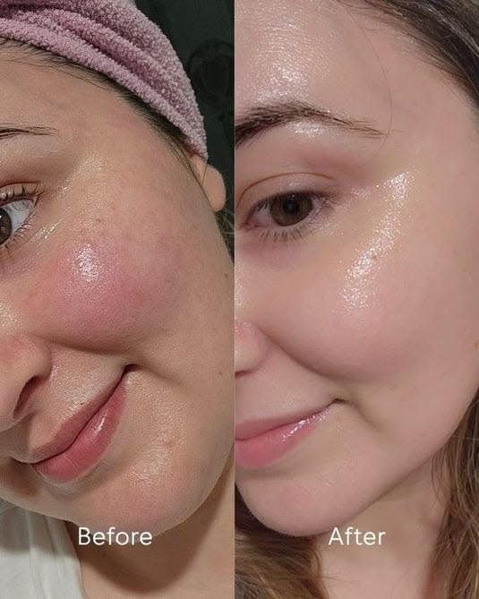 Rejuvenating Facial Mask